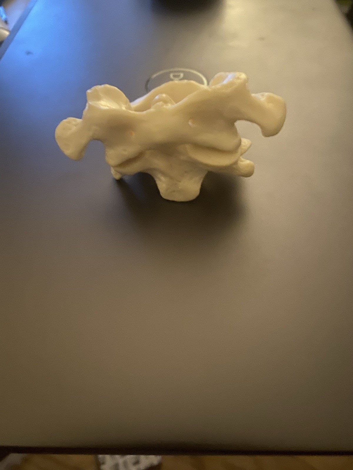 Atlas Axis Articulation Plastic Model For Chiropractic Office