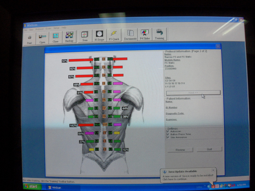 Laptop w/Validated Myovision 8000 Software Installed Ready to Use! Chiropractic.