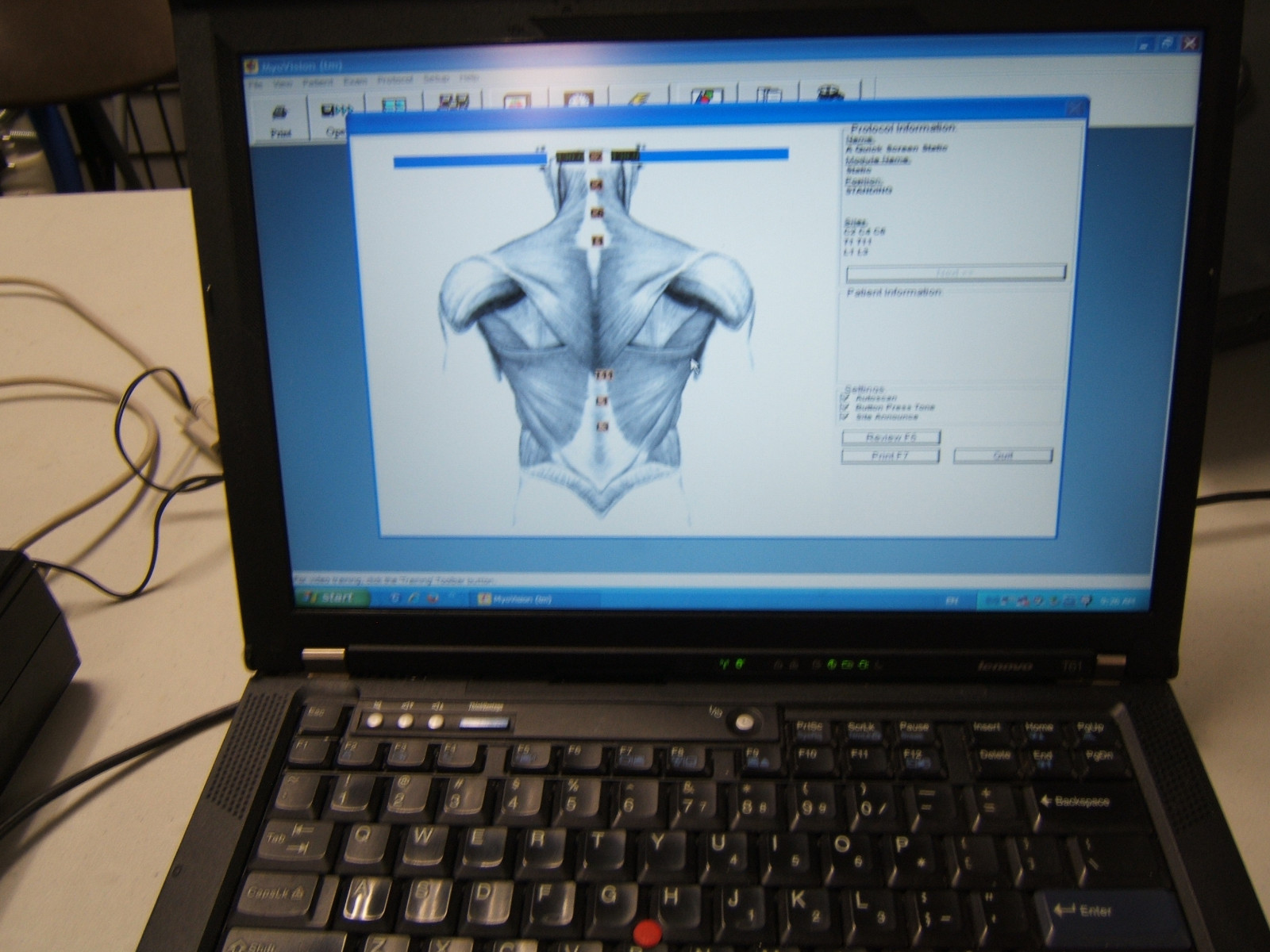 Myovision 8000 Software CD, Chiropractic, Chiropractor