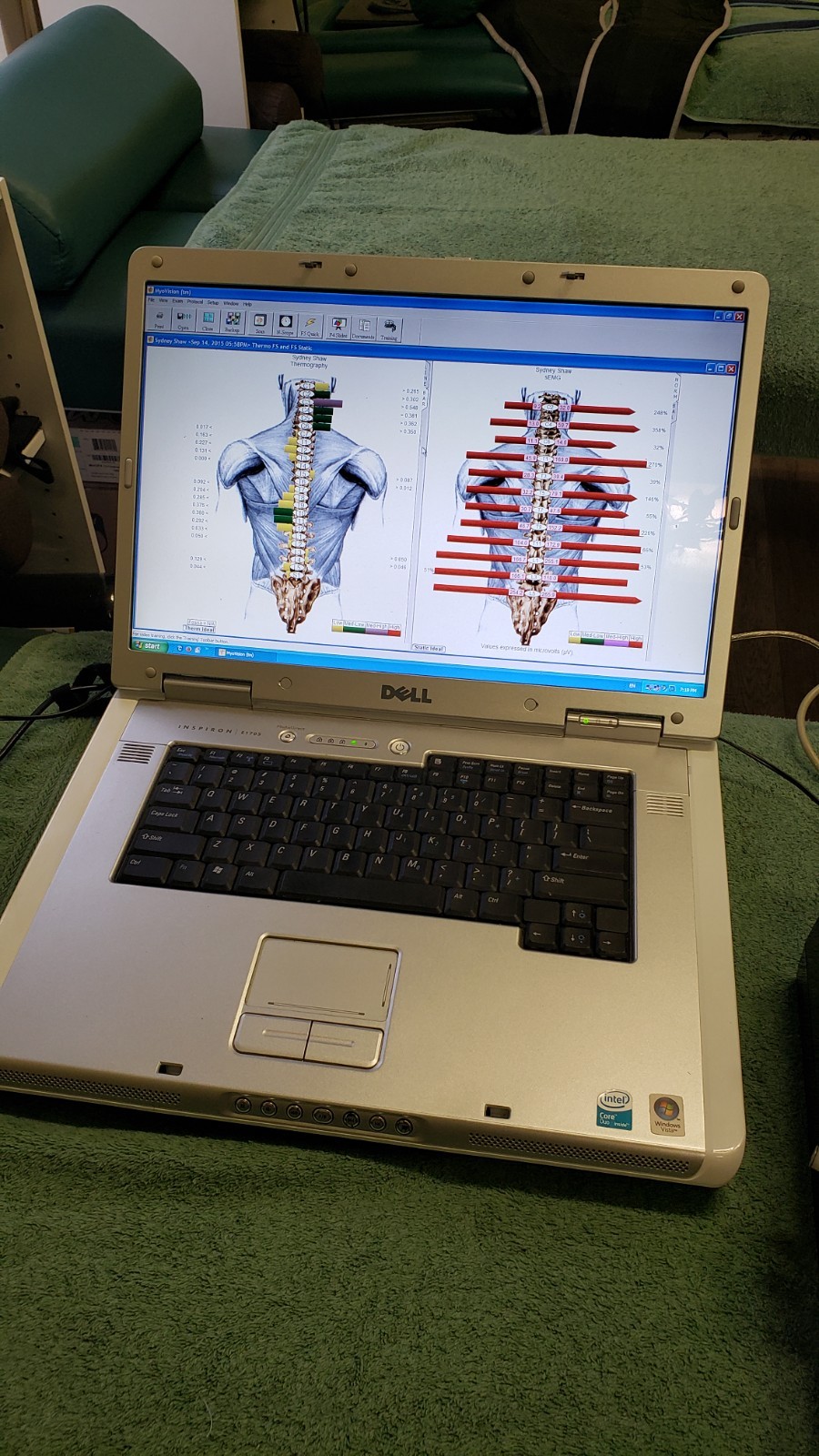 HUGE Screened Laptop w/Validated Myovision 8000 Software Install Chiropractic
