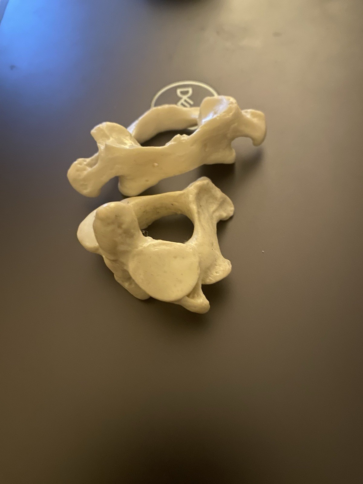 Atlas Axis Articulation Plastic Model For Chiropractic Office