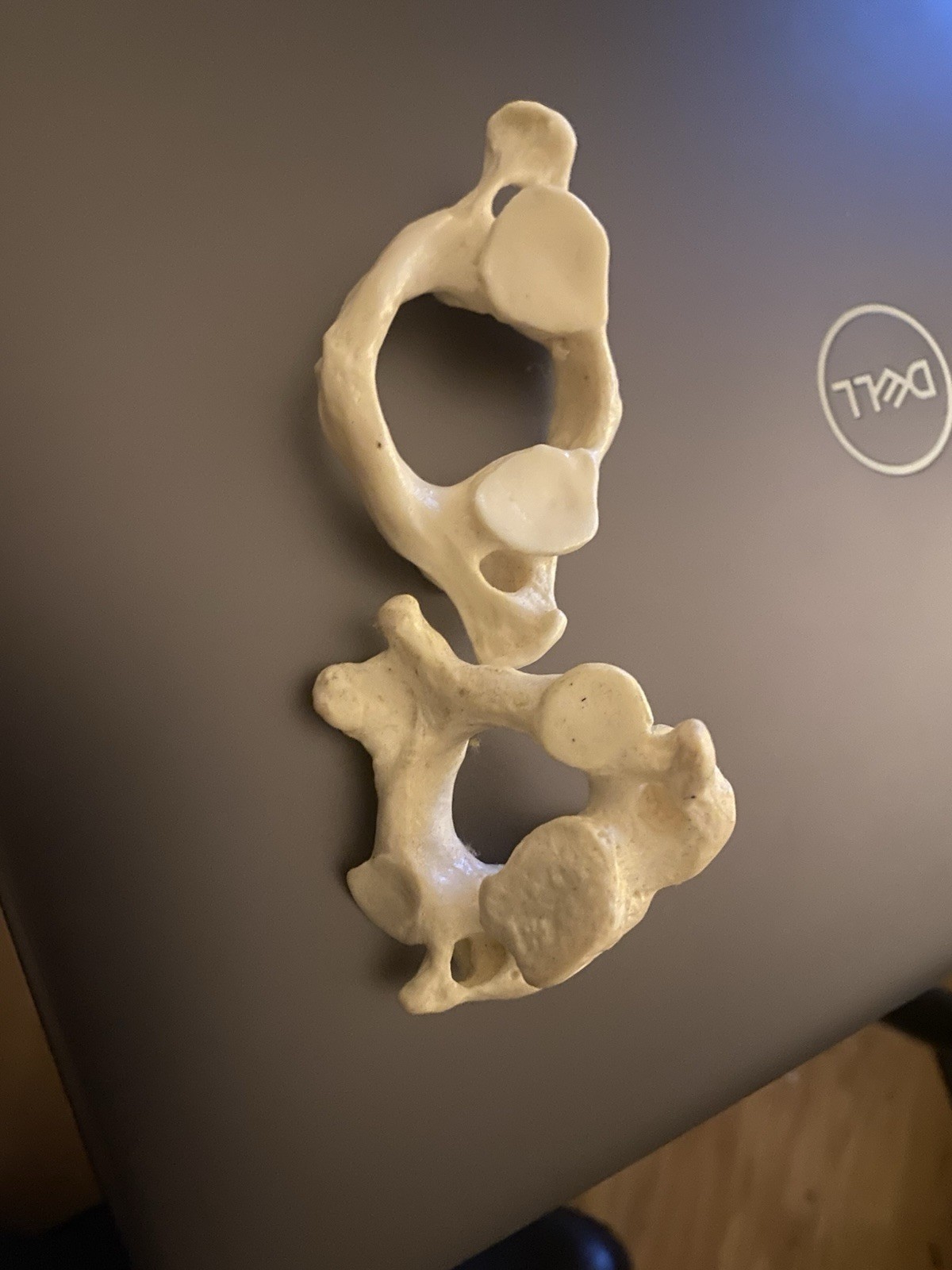 Atlas Axis Articulation Plastic Model For Chiropractic Office