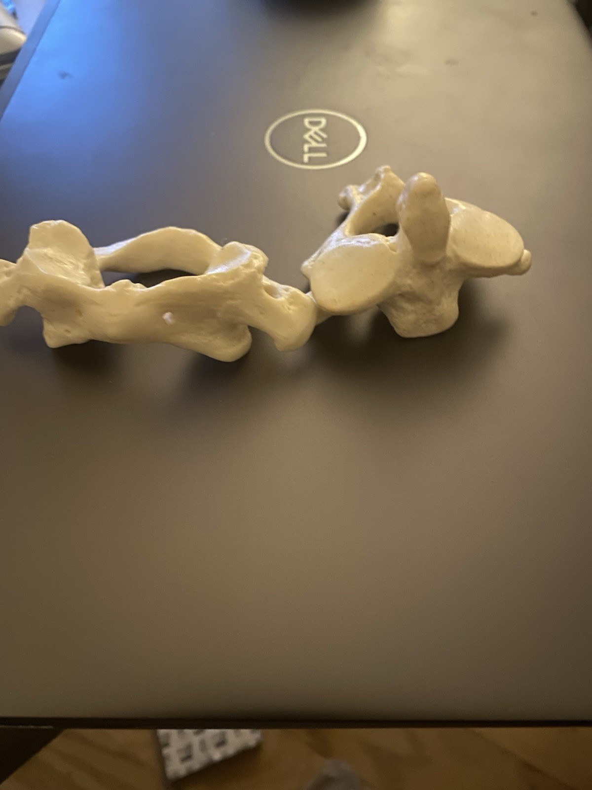 Atlas Axis Articulation Plastic Model For Chiropractic Office